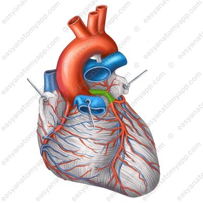 Левая коронарная артерия (arteria coronaria sinistra) – вид спереди