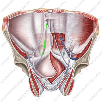Medial umbilical fold (plica umbilicalis medialis)