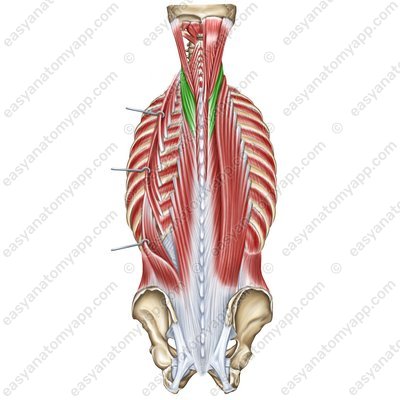 Longissimus muscle – cervices part (m. longissimus cervicis)