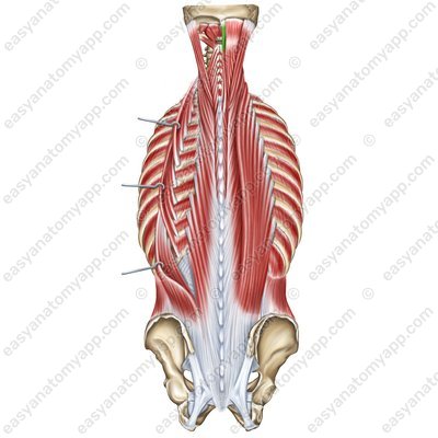 Spinalis muscle – cranial part (m. spinalis capitis)