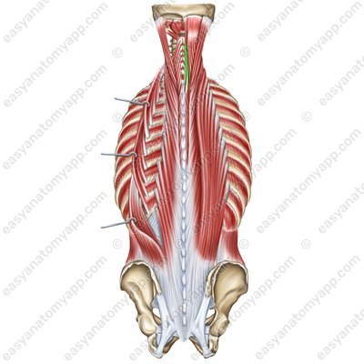 Spinalis muscle – cervical part (m. spinalis cervicis)