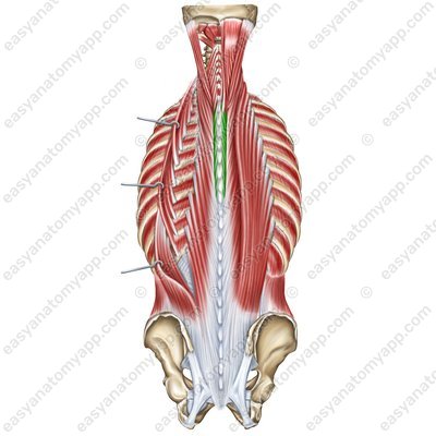 Spinalis muscle – thoracic part (m. spinalis thoracis)