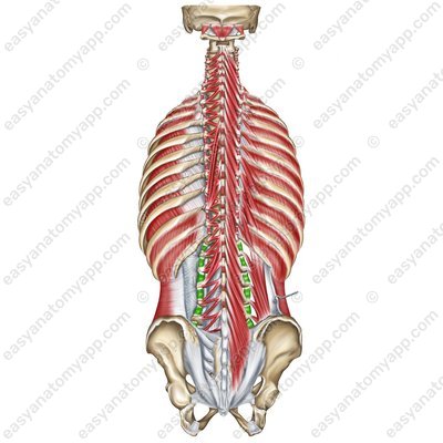 Zwischenquermuskeln – Pars lumbalis (mm. intertransversarii laterales lumborum)