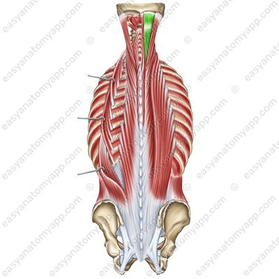 Halbdornmuskel – Pars cranialis (m. semispinalis capitis)