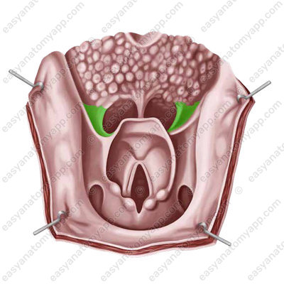 Lateral glosso-epiglottic fold (plica glossoepiglottica lateralis)